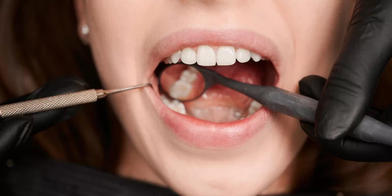 img-especialidades-periodontia-18
