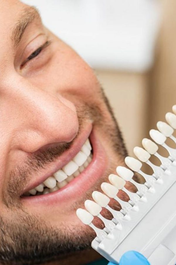 implante-dentario-1-scaled-1